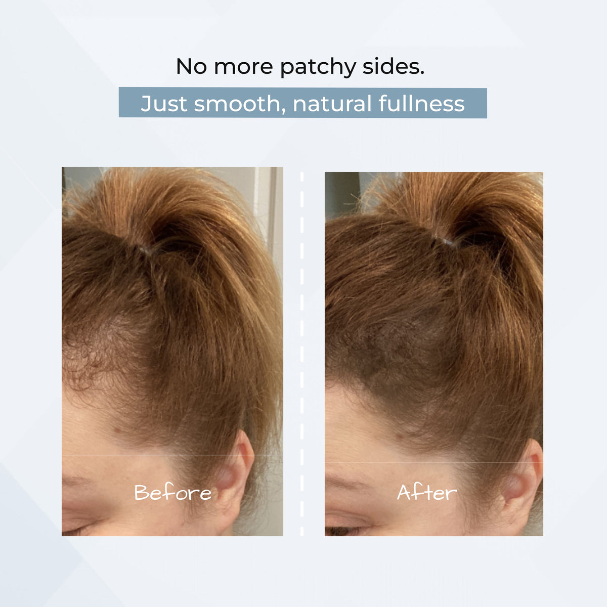 HairMagic+ Hairline Powder For Thinning Hair