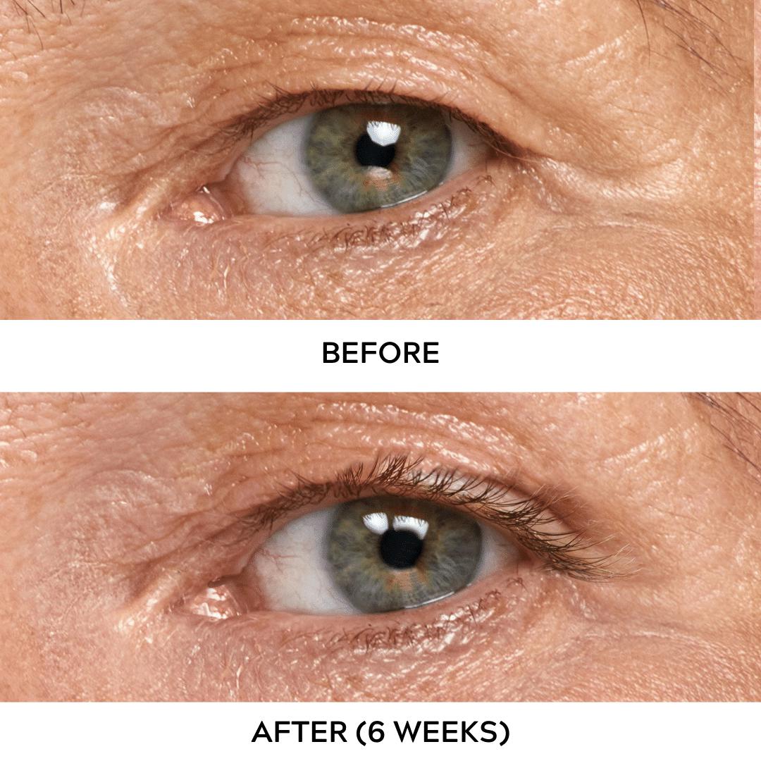 Best Eyelash Growth Serum UK